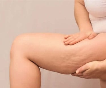 How to in vivo Objectivate Slimming Claims? 4 EC 0923 web3 1