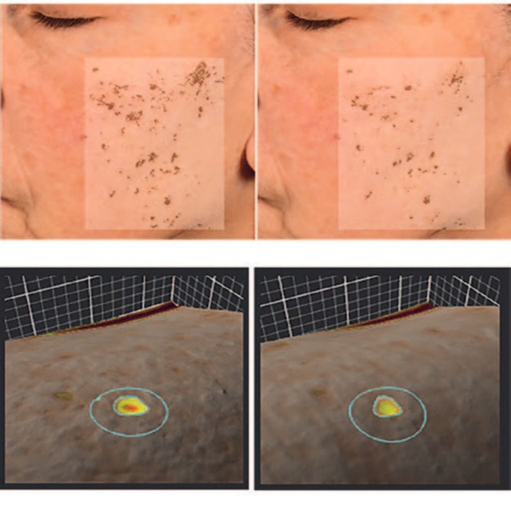 How to stop the skin from ageing faster than it should 9 EC 0923 web3 3