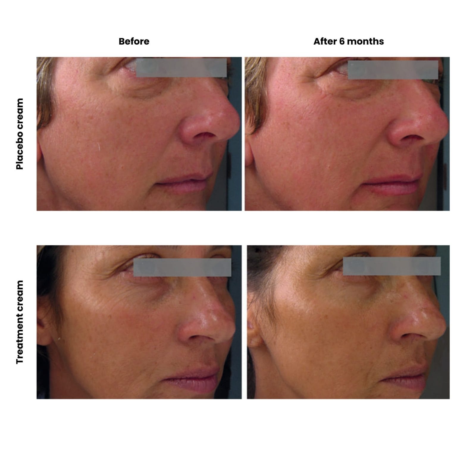 How to stop the skin from ageing faster than it should 8 Before 1920 x 1920