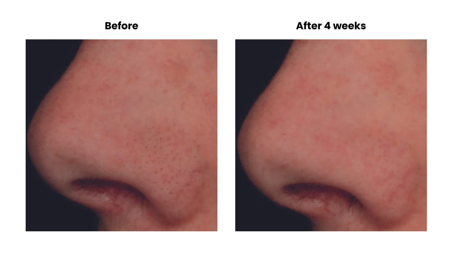How to stop the skin from ageing faster than it should 11 Minimalist Tech Startup Introduction Pitch Presentation